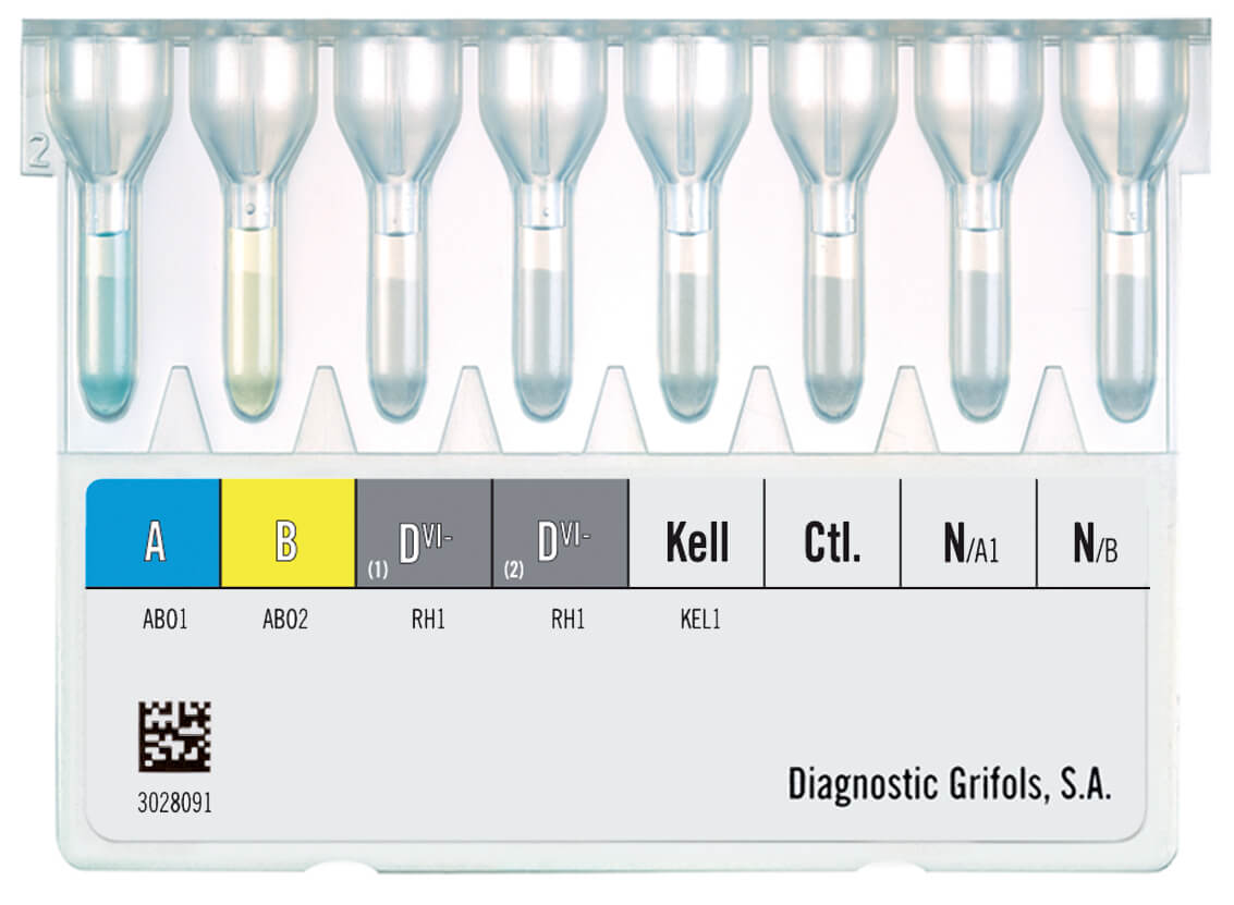 File:Blood typing by gel card method (column agglutination or MTS gel) -  type O positive.jpg - Wikipedia